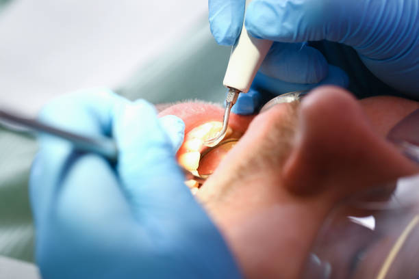 Dentist for Dental Trauma in GA