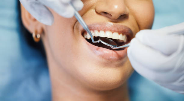 Best Knocked-Out Tooth Emergency  in Greensboro, GA