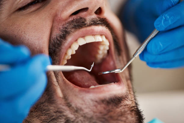 Best Cracked Tooth Emergency Dentist  in Greensboro, GA